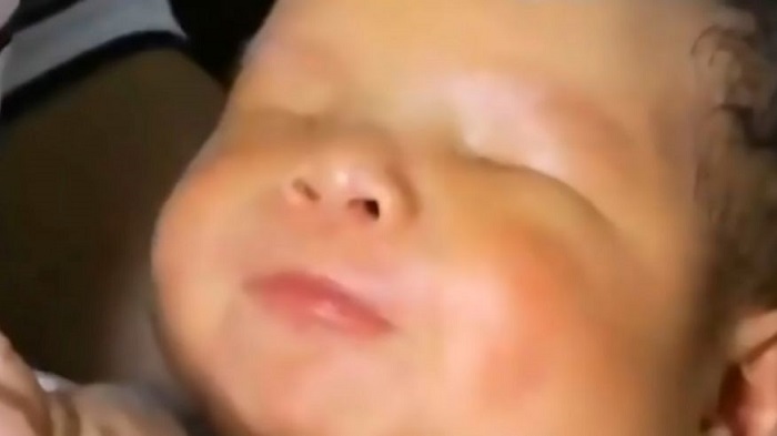 Baby born without eyes despite mom`s normal pregnancy 
